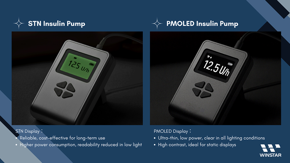 PMOLED İnsülin Pompası - Ultra ince, düşük güç, her ışık koşulunda net, yüksek kontrast, statik ekranlar için ideal