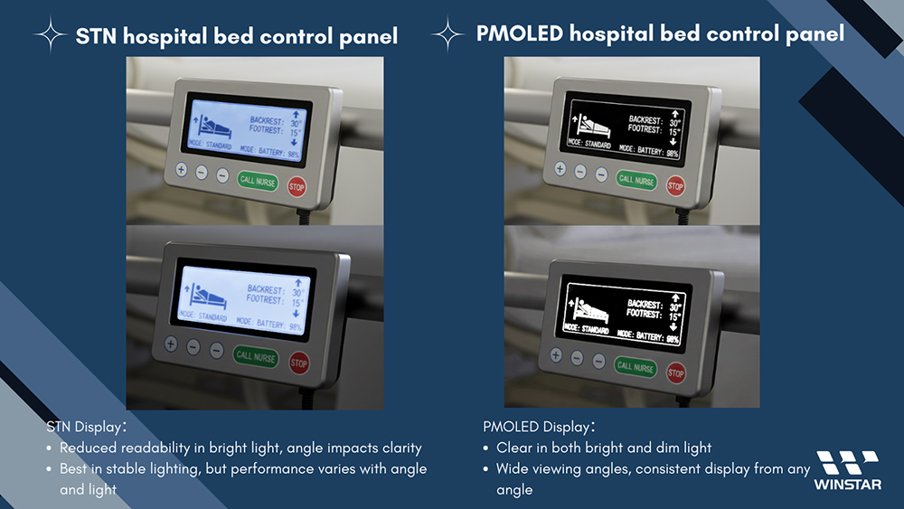 PMOLED hastane yatak kontrol paneli - Hem parlak hem de loş ışıkta net, her açıdan tutarlı görüntüleme