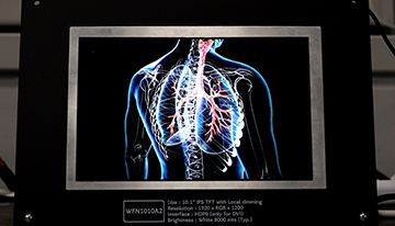 Embedded World 2026 TFT 顯示模組展示